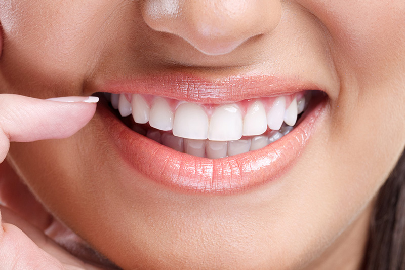 teeth-whitenin